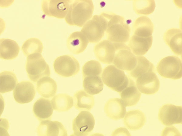 Two trophozoites, pear-shaped, of Babesia divergens in erythrocytes from case-patient 1 (original magnification ×1,000, May-Grünwald-Giemsa stain).