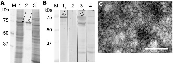 Parvovirus 4 (PARV4) virus-like particle (VLP) expression and immunoreactivity, Finland. A) Sodium dodecyl sulfate–polyacrylamide gel electrophoresis of PARV4-like particles in Spodoptera frugiperda armyworm (Sf)9 cells (lane 1), purified VLPs (lane 2), and uninfected Sf9 cells (lane 3). B) Western blotting with PARV4 immunoglobulin (Ig) G–positive serum (lanes 1, 3, and 4) or PARV4 IgG–negative serum (lane 2). Lanes 1 and 2, purified VLPs as antigen; lane 3, Sf9 cells expressing VLPs; lane 4, S