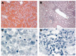 Thumbnail of Photomicrographs of lung, liver, and kidney sections from patient 2 during study, Missouri and Florida, USA, 2009. Hematoxylin and eosin stain showed pulmonary hemorrhage (A) (original magnification ×10) and interstitial nephritis (B) (original magnification ×5), 2 characteristic pathologic findings of leptospirosis. Immunohistochemical testing showed scattered granular leptospiral antigens in liver (C) and kidney (D) (original magnification ×63).