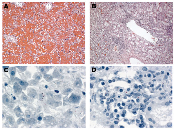Photomicrographs of lung, liver, and kidney sections from patient 2 during study, Missouri and Florida, USA, 2009. Hematoxylin and eosin stain showed pulmonary hemorrhage (A) (original magnification ×10) and interstitial nephritis (B) (original magnification ×5), 2 characteristic pathologic findings of leptospirosis. Immunohistochemical testing showed scattered granular leptospiral antigens in liver (C) and kidney (D) (original magnification ×63).