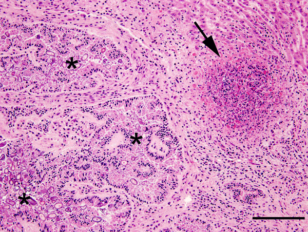 Liver from a juvenile wild rabbit with numerous oval Eimeria stiedae oocysts in the convoluted hyperplastic bile ducts (asterisks) and necrotizing hepatitis (arrow) by Francisella tularensis. Hematoxylin and eosin stain; scale bar = 200 µm.