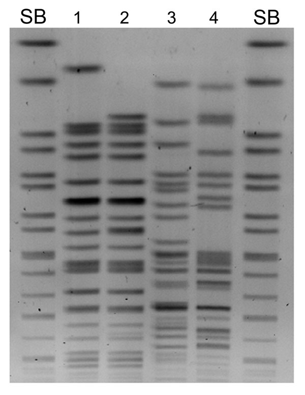 Macrorestriction analysis (XbaI) by pulsed-field gel electrophoresis of Klebsiella pneumoniae N100469 (lane 1), K. pneumoniae N10–0506 (lane 2), Escherichia coli N10–0505 (lane 3), E. coli N10–0705 (lane 4), Salmonella enterica serovar Branderup molecular mass marker (XbaI) (lanes SB)..