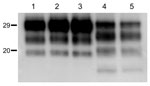Thumbnail of Western blot analyses of brain protease-resistant prion protein (PrPres) from BSE-H infected mice by using Saf84 monoclonal antibody. Tg110 mice infected with isolate 02-2695 (lanes 2 and 3) or 45 (lane 4) at first passage showing either high-type (lane 2) or classical BSE–like PrPres molecular profile (lanes 3 and 4). The BSE-H isolate (02–2695) (lane 1) and a BSE-C isolate (lane 5) were included for comparison. Similar quantities of PrPres were loaded in each lane. Values to the l