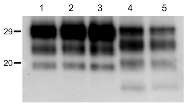 Western blot analyses of brain protease-resistant prion protein (PrPres) from BSE-H infected mice by using Saf84 monoclonal antibody. Tg110 mice infected with isolate 02-2695 (lanes 2 and 3) or 45 (lane 4) at first passage showing either high-type (lane 2) or classical BSE–like PrPres molecular profile (lanes 3 and 4). The BSE-H isolate (02–2695) (lane 1) and a BSE-C isolate (lane 5) were included for comparison. Similar quantities of PrPres were loaded in each lane. Values to the left indicate