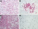 Thumbnail of Results of in situ hybridization experiments. Hybridization of β-actin–specific and turkey hepatitis virus (THV)–specific oglionucleotide probes with FastRed staining on hepatitis-affected liver tissue from poult 2993A (A and B, respectively) and on nondiseased liver tissue from poult 1927B (C and D, respectively). Brightfield microscopy images; original magnification ×40.