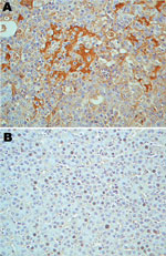 Thumbnail of Immunohistologic staining of liver tissues with serum from a turkey poult with turkey viral hepatitis (TVH). Serum sample from PCR-positive poult 394.9 demonstrates turkey hepatitis virus (THV) antigens in clusters of cells in liver tissue of TVH-affected poult 2993A (A) but not in liver sections from nondiseased poult 1927B (B). Sections were counterstained with hematoxylin. Brightfield microscopy images; original magnification ×40.