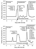 Thumbnail of Examples of relapsing fever episodes in 2 patients with Borrelia miyamotoi infection. Arrows indicate the timing of tick bite, hospital admission, PCR testing, anti-borreliae immunoglobulin (Ig) M testing, and initiation of antimicrobial drug therapy.