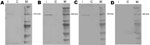 Thumbnail of Results of serologic analysis by Western blot of serum specimens from patient 2, a 22-month-old girl with acute necrotizing ancephalopathy. Three serum specimens from patient 2, harvested at 6 (A), 13 (B), and 19 (C) days after onset of symptoms, and a serum specimen from a healthy donor (D) were incubated with reovirus MRV2Tou05–infected and –noninfected BGM cells. I, infected; C, noninfected; M, molecular weight markers (Precision Plus protein standards).
