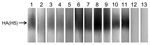 Thumbnail of Western blot analysis of virus neutralization (VN)–positive raccoon serum specimens. A/whooper swan/Mongolia/4/05 (H5N1) virus (clade 2.2) was purified through a 25% sucrose cushion and used as an antigen under nonreducing conditions in the Western blot assay. After blocking with 5% skim milk, each raccoon serum specimen (1:100 dilution) was incubated for 1 h and then reacted with horseradish peroxidase (HRP)–labeled protein A/G (Pierce Chemical Co., Rockford, IL, USA) and subjected