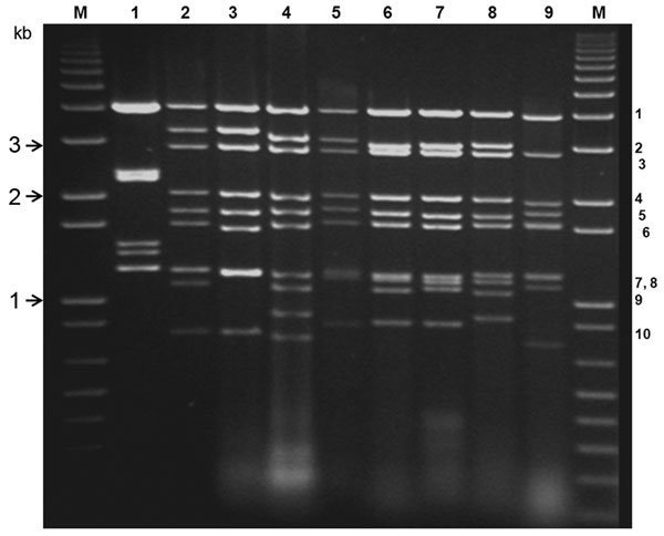 Electrophoretic analysis of genomic double-stranded RNAs from the Orbivirus species and mammalian orthoreoviruses. Bluetongue virus double stranded RNA preparations were analyzed by electrophoresis in a 1% agarose gel containing 0.5 μg/mL ethidium bromide and visualized by exposure to ultraviolet light. Genome segments are numbered, in order of decreasing molecular weight. DNA markers were run (lanes M) to enable estimation of molecular weights. Lane 1, orthoreovirus (MOR2004/01); 2, equine ence