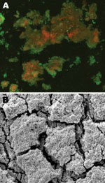 Thumbnail of A) Confocal scanning laser microscopy image of central venous catheter tip in a patient with Nocardia nova complex central line–associated bloodstream infection. Bright green objects are viable biofilm bacteria, and orange-red objects are dead bacteria. Original magnification ×25. B) Scanning electron microscopy image of central venous catheter tip reveals biofilm surface structure. Original magnification ×5,000.