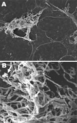 Thumbnail of Scanning electron microscopy of Nocardia spp. biofilm on silicone central venous catheters. A) N. nova complex (disseminated Nocardia bacteremia) on the surface, showing heavy biofilm matrix covering filamentous cells. B) N. nova complex (definite central line–associated bloodstream infection) showing network of filamentous (thin arrow), partially covered with opaque biofilm matrix (thick arrows). Original magnifications ×2,500.