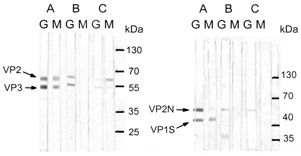 Immunoglobulin (Ig) G and IgM immunoblots of 3 mothers for infection with parvovirus 4 (PARV4) (left) or parvovirus B19 (B19V) (right). Case-patient A was co-infected with PARV4 and B19V; case-patient B was the only mother who did not have IgM against PARV4; case-patient E had weak IgM against PARV4 viral protein (VP) 3 and IgM against B19V VP2N, which could not be seen after scanning. Molecular weights are ≈60 kDa for PARV4 VP2, 51 kDa for PARV4 VP3, 51 kDa for B19V VP2N, and 41 kDa for B19V VP