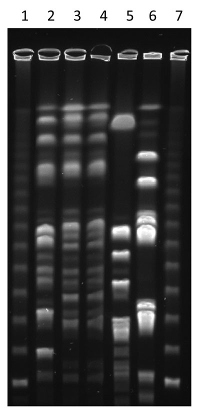 Pulsed-field gel electrophoresis of Staphylococcus aureus. Isolates were digested with Cfr9I. Lanes 1 and 7, molecular mass ladder; lane 2, t034 sequence type (ST) 398 isolate from pig; lane 3, t571 ST398 nasal isolate from colonized childcare employee; lane 4, t571 ST398 throat isolate from colonized childcare employee; lanes 5 and 6, non-ST398 isolates (t2228 and t084, respectively) from 2 other childcare employees.