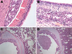 Thumbnail of Hematoxylin and eosin–stained trachea and lung controls and samples from pigs infected with pandemic (H1N1) 2009 virus. A) Control trachea sample; B) mixed inflammatory cell infiltrate present throughout trachea sample from infected pig. C) Control lung sample; D) mixed inflammatory infiltrate and interstitium broadening in lung sample from infected pig. Original magnifications: panels A and B, ×40; panels C and D, ×10.