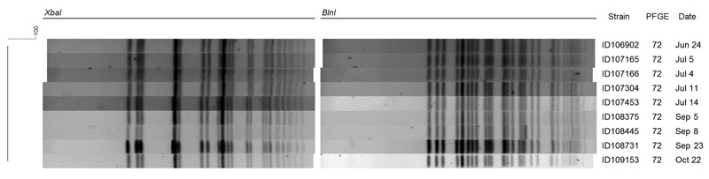 Digestion pattern of ciprofloxacin-resistant Shigella sonnei isolated from 9 patients for XbaI and BlnI, Montréal, Québec, Canada, June–October 2010. PFGE, pulsed-field gel electrophoresis.