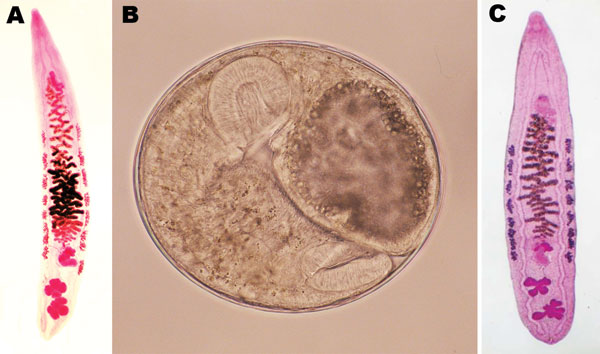 A) Adult Opisthorchis viverrini liver fluke (length 12.0 mm) isolated from a human after chemotherapy and purgation in Takeo Province, Cambodia, showing the characteristic morphology of the two 4–5-lobulated testes. B) Metacercaria of O. viverrini fluke (diameter 0.22 mm) detected in a freshwater fish (Puntioplites proctozysron). C) Young adult O. viverrini fluke (length 5.5 mm) isolated 6 weeks after experimental infection of a hamster with metacercariae from P. proctozysron fish. Original magn