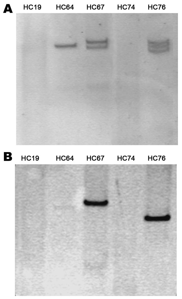 Plasmidic profile of the enteroaggregative Escherichia coli strains (A) and Southern blotting of the blaCTX-M-15 gene (B).