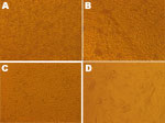 Thumbnail of Effect of chikungunya virus nucleic acid–positive serum specimens on C6/36 and BHK-21 cells, Guangdong, China, 2010. A) Control (uninfected) C6/36 cells. B) Infected C6/36 cells, showing cytopathic effect. C) Control (uninfected) BHK-21 cells. D) Infected BHK-21 cells, showing cytopathic effect. (Original magnifications ×200.)