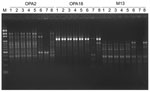 Thumbnail of Random amplified polymorphic DNA patterns of 8 isolates of Mycobacterium abscessus generated by arbitrarily primed PCR with the primers OPA2, OPA18, and M13 (Operon Technologies, Inc., Alameda, CA, USA). Lanes: M, molecular size marker (1-kb ladder; Gibco BRL, Gaithersburg,MD, USA); 1, isolate A; 2, isolate B; 3, isolate C; 4, isolate D; 5, isolate F; 6–8, three unrelated isolates of M. abscessus recovered from cutaneous lesions of 3 patients who were treated at National Taiwan Univ