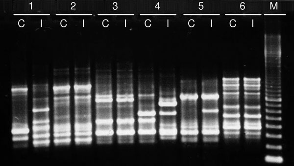 Enterobacterial repetitive intergenic consensus sequence type 2 PCR patterns of pairs of Escherichia coli isolates from 6 patients examined during study of extended-spectrum β-lactamase–producing Enterobacteriaceae infection among liver transplant recipients, France, January 2001–April 2010. The pretransplant colonizing isolate (C) and the posttransplant infecting isolate (I) show identical patterns for patients 2, 3, and 6 and different patterns for patients 1, 4, and 5. M, molecular mass stand