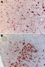 Thumbnail of Immunohistochemical analysis of brain of Natterer’s bat for lyssavirus antigen by using the avidin biotin complex method. A) Cerebrum showing a large number of neurons. Cytoplasmic granular-to-diffuse staining for rabies antigen is visible in the perikarya and neuronal processus. B) Medulla and neurons of the nucleus funiculi lateralis showing strong cytoplasmic staining for rabies antigen. Original magnifications ×20.