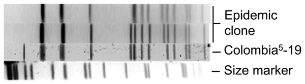 Restriction fragment-length polymorphism pattern of Streptococcus pneumoniae serotype 5 from epidemic in western Canada, 2000–2009 (epidemic clone), determined by pulsed-field gel electrophoresis. The Colombia5-19 strain is from the Pneumococcal Molecular Epidemiology Network (www.sph.emory.edu/PMEN) (17).