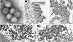 Thumbnail of Electron microscopy of pandemic (H1N1) 2009 virus. A) Negatively stained virions grown in MDCK cells showing spherical particles with distinct surface projections. Scale bar = 100 nm. B) Filamentous and ovoid particles assembling at the plasma membrane. Scale bar = 100 nm. C) Extracellular particles showing internal nucleocapsids, seen in cross-section, surrounded by an envelope with prominent spikes. Note all 8 nucleocapsids present in 1 virion (arrow). Scale bar = 100 nm. D) Dense