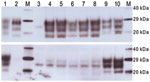 Thumbnail of Western blot analysis of a range of murine transmissible spongiform encephalopathy–affected brain homogenates in host-encoded prion protein (PrP)–a (RIII) mice. A) Western blot probed with SHA31, 15-s exposure time. B) Western blot probed with 12B2, 5-min exposure time. M, biotinylated marker; lane 1, ovine scrapie field case; lane 2, bovine spongiform encephalopathy (BSE) field case; lane 3, unchallenged mouse; lane 4, bovine BSE-challenged mouse; lane 5, ovine BSE-challenged mouse