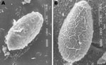 Thumbnail of Scanning electron microscopy images of A) an egg of the Ecuadorian Amphimerus spp. trematode (original magnification ×3) obtained from a human and B) an egg of the Asian Clonorchis sinensis trematode (original magnification ×4). Although the size is similar, the pattern of the surface is different, thus differentiating the 2 genera.