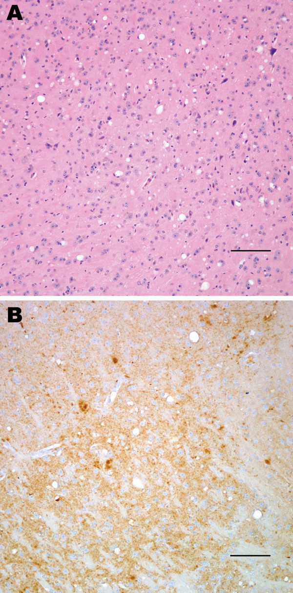 Histopathologic analysis of transgenic mouse expressing bovine prion protein (PrP) gene inoculated with bovine spongiform encephalopathy agent. Spongiform degeneration in the thalamus (A), adjacent section showing PrP immunopositivity (B). Panel A was stained with hematoxylin and eosin, panel B was immunostained with PrP antibody 6D11. Scale bars = 100 μm.
