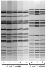 Thumbnail of XbaI pulsed-field gel electrophoresis patterns of pathogenic Escherichia coli from humans and venison, Minnesota, USA, November 2010. Lanes 2, 4, 6, and 8, isolates from venison. Lanes 1, 3, 5, and 7, isolates from human case-patients.