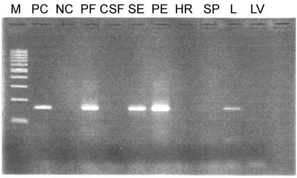 PCR product of postmortem samples RP381/11 on 3% agarose gel in study of human adenovirus type 7 outbreak in a police training center, Malaysia, 2011. M, 100-bp ladder; PC, positive control; NC, negative control; PF, pericardial fluid; CSF, cerebrospinal fluid; SR, serum; PE, pleural effusion; HR, heart; SP, spleen; L, lung tissue, LV, liver.