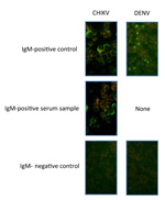 Thumbnail of Images of immunofluorescence assays in Vero E6 cells for IgM against chikungunya virus (CHIKV) and dengue virus (DENV). For each of the viruses, a positive control, an example of a positive serum sample (if available), and a negative control are shown. Original magnification ×200.