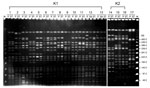 Thumbnail of Pulsed-field gel electrophoresis of randomly selected isolates of Klebsiella pneumoniae from 17 patients with liver abscess, Taiwan, January 2009–December 2010. DNA fragments were subjected to electrophoresis after digestion with XbaI. Lanes 1–13, serotype K1 isolates; lanes 14–16, serotype K2 isolates; lane 17, serotype non-K1/K2 isolates. M, molecular mass marker; P, liver aspirate; ST, stool; SA, saliva.