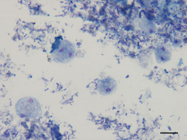 Dientamoeba fragilis trophozoites in a smear of pig feces after Giemsa staining, Italy, 2010–2011. Scale bar = 10 μm.