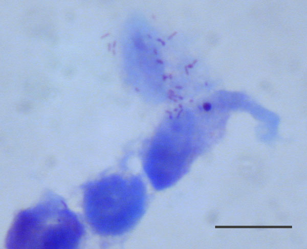 Rickettsia sp. AvBat in XTC-2 cell culture with Gimenez staining. Scale bar = 20 μm. 