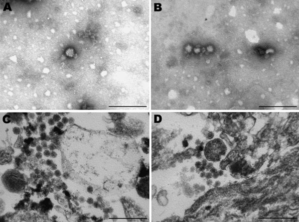 Electron micrographs of Vero cells infected with virus from horse SAE 18/09. A, B) Negative stain showing fringed particles (bunyavirus size) with bleb formation. Scale bar = 250 nm. C, D) Resin section showing spherical and pleomorphic bunyavirus particles in the range of 80–100 nm. Scale bar = 250 nm.