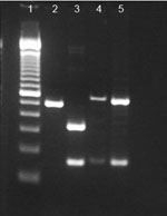 Thumbnail of BsrDI digest of tprI and BsrDI/BsEI double digest of tprC from the oral ulcer swab specimen and the syphilis control strain Nichols. Lanes from left to right: 1, 100-bp ladder; 2, Nichols tprI product not digested with BsrDI (493-bp band); 3, clinical specimen tprI product digested with BsrDI (334-bp and 159-bp bands); 4, Nichols tprC digested with BsrDI/BsiEI (547-bp and 160-bp bands); 5, clinical specimen tprC digested with BsrDI/BsiEI (547-bp and 160-bp bands).