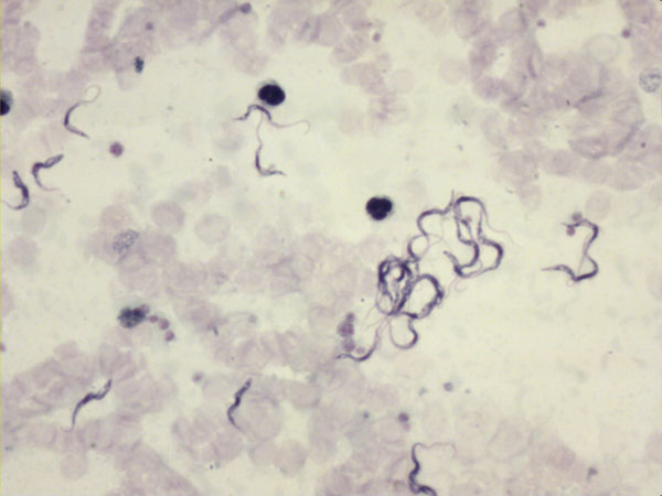 Thick film using Field’s stain showing trypanosomes under ×400 magnification. Motile trypanosomes are shown in the Video.