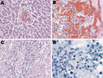 Thumbnail of Histopathologic evaluation of tissue samples collected postmortem from a person co-infected with Leptospira spp. and dengue virus 1. Tissue specimens were taken from the liver (A), lung (B) and kidney (C and D) and stained with hemotoxylin-eosin (A, B, C; original magnification ×20) or probed with poly clonal anti-Leptospira antibody for immunohistochemical detection of Leptospira antigen (D; arrowheads indicate antigen; original magnification ×63).