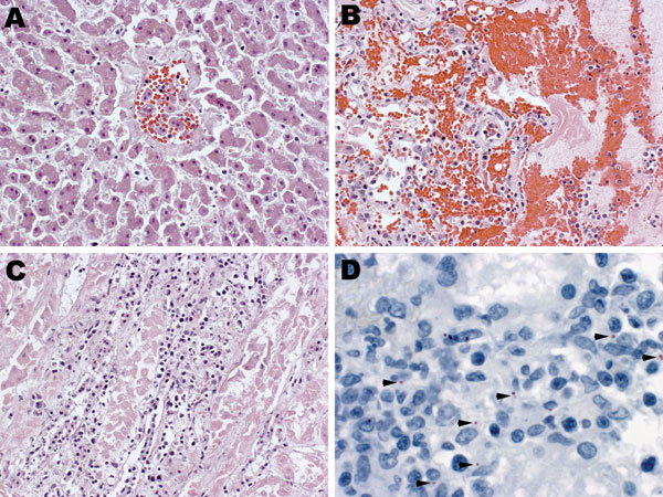 Histopathologic evaluation of tissue samples collected postmortem from a person co-infected with Leptospira spp. and dengue virus 1. Tissue specimens were taken from the liver (A), lung (B) and kidney (C and D) and stained with hemotoxylin-eosin (A, B, C; original magnification ×20) or probed with poly clonal anti-Leptospira antibody for immunohistochemical detection of Leptospira antigen (D; arrowheads indicate antigen; original magnification ×63).