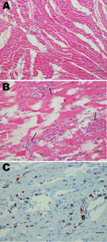 Thumbnail of Postmortem tissue sections from chimpanzee with coxsackie virus B infection, Denmark. A) Myocardial section showing artifacts of freezing and a diffuse lymphocytic infiltration. Scale bar = 80 µm. B) Myocytic degeneration (arrows) is evident. Scale bar = 40 µm. C) CD3 marker reaction showing T lymphocytes. Scale bar = 40 µm.