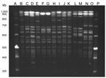 Thumbnail of Pulsed-field gel electrophoresis of SmaI-digested Enterococcus faecalis isolated from humans with urinary tract infections and from poultry in the same houselhold, Vietnam, January 2008–January 2010. Lanes A and P are molecular weight markers. Lane B, isolate 90U; lane C, isolate 90P; lane D, 122U; lane E, 122P; lane F, 186U; lane G, 186P; lane H, 191U; lane I, 191P; lane J, 204U; lane K, 204P; lane L, 217U; lane M, 217P; lane N, 221U; and lane O, 221P.
