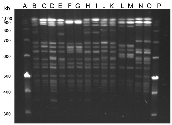 Pulsed-field gel electrophoresis of SmaI-digested Enterococcus faecalis isolated from humans with urinary tract infections and from poultry in the same houselhold, Vietnam, January 2008–January 2010. Lanes A and P are molecular weight markers. Lane B, isolate 90U; lane C, isolate 90P; lane D, 122U; lane E, 122P; lane F, 186U; lane G, 186P; lane H, 191U; lane I, 191P; lane J, 204U; lane K, 204P; lane L, 217U; lane M, 217P; lane N, 221U; and lane O, 221P.
