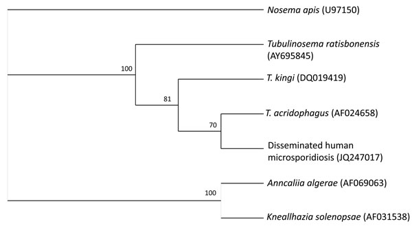 Cladogram of Tubulinosematidae spp. based on small subunit ribosomal RNA gene sequences. Nosema apis was added as an outgroup. The phylogenetic tree was created by using the quartet puzzling maximum likelihood program TREE-PUZZLE (www.tree-puzzle.de). The numbers at the nodes are quartet puzzling estimations of support to each internal branch.