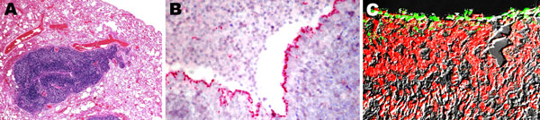 Micrographs of a section of lung from a 2-year-old ferret that died of acute dyspnea. A) Image shows moderate bronchointerstitial pneumonia with severe hyperplasia of bronchiole-associated lymphoid tissue around a narrowed airway lumen; magnification ×4. B) Immunohistochemical analysis conducted with antibodies against mycoplasmas demonstrates intense labeling along the apical border of the ciliated respiratory epithelium; magnification ×40. C) Confocal scanning laser microscopy conducted with a