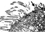 Thumbnail of Transmission electron micrograph of the lung from a 2-year-old ferret that died of acute dyspnea, showing loss of cilia in bronchial epithelial and cellular degeneration characterized by swelling of endoplasmatic reticulum, vacuolization of mitochondria with loss of christae, and intranuclear chromatin dispersion. Attached to the apical surface of a ciliated cell is a 0.8-μm pleomorphic mycoplasma-like organism (arrow). Scale bar = 0.5 µm.