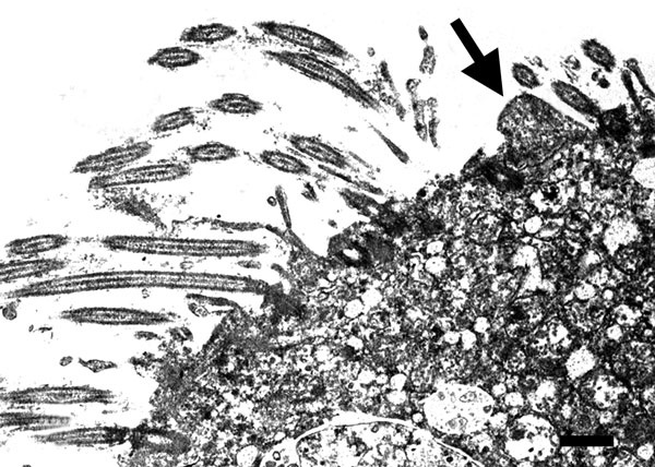 Transmission electron micrograph of the lung from a 2-year-old ferret that died of acute dyspnea, showing loss of cilia in bronchial epithelial and cellular degeneration characterized by swelling of endoplasmatic reticulum, vacuolization of mitochondria with loss of christae, and intranuclear chromatin dispersion. Attached to the apical surface of a ciliated cell is a 0.8-μm pleomorphic mycoplasma-like organism (arrow). Scale bar = 0.5 µm.