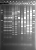Thumbnail of rep-PCR fingerprint patterns of patient and household isolates, New York, New York, USA, 2001-2011. Lane 1, 100-bp ladder; lane 2, patient no. 5 Mycobacterium avium isolate AG-P-1; lane 3, patient no. 5 household filter M. avium isolate AG-F-2–0-2; lane 4, patient no. 5 household filter M. avium isolate AG-F-2-I-1; lane 5, patient no. 6 M. abscessus-chelonae complex (MAC-X) isolate GG-P-1; lane 6, patient no. 6 household swab M. chimaera isolate GG-Sw-9–1; lane 7, patient no. 8 M. a